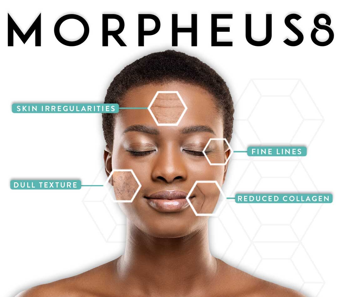 morpheus8-infographic-instagram-post-black-hair-preview-1 (1)