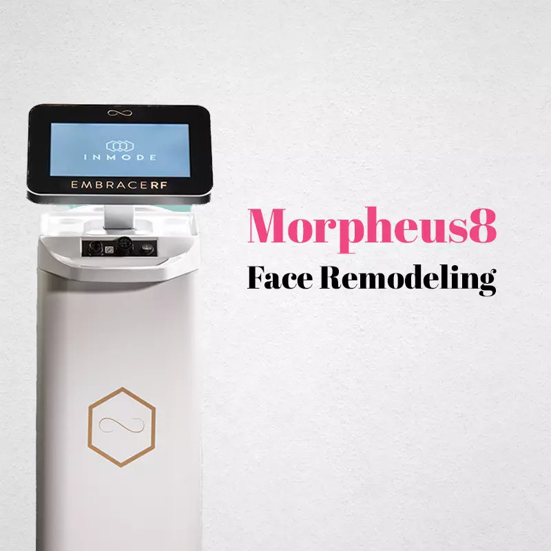 Morpheus8: The New Non-invasive Face Lift