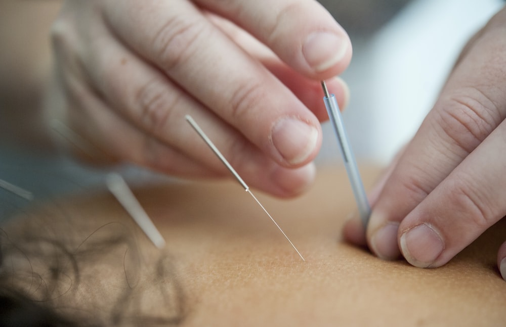 Acupuncture 101: A Complete Guide by Dr. Steven Silverman, D.C.